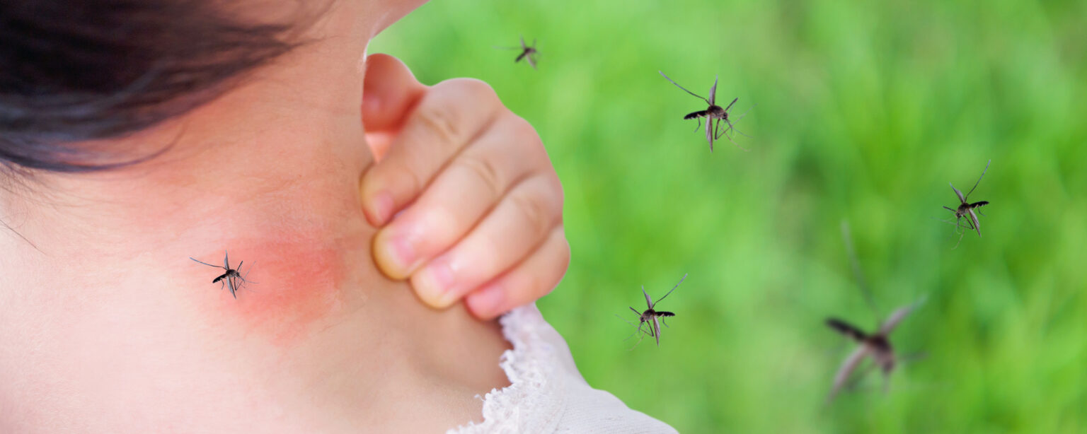 4 Helpful Tips to Avoid Being a Mosquito Magnet